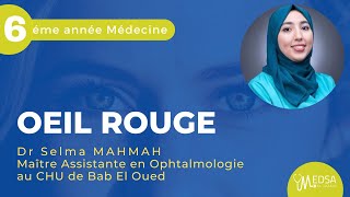 ŒIL ROUGE  Dr Selma MAHMAH [upl. by Htes]