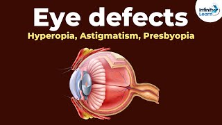 Eye defects  Hyperopia Astigmatism Presbyopia  Dont Memorise [upl. by Newman]