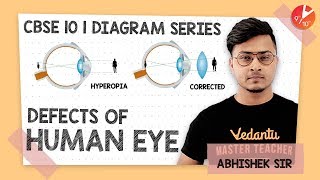 Defects of Human Eye Diagram  Diagram Series  CBSE Class 10 Physics Chapter 11  Vedantu Class 10 [upl. by Brand]