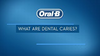 What are Dental Caries Treatments Signs and Symptoms  OralB [upl. by Nosirb]