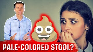 What Does PaleColored Poop Mean – DrBerg [upl. by Kedezihclem]