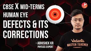 Human Eye 1  Defects of Vision and their Correction  CBSE Class 10 Physics Chapter 11  Midterm [upl. by Mccreery478]