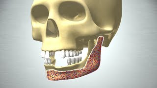 Revolution in Bone Regeneration [upl. by Trula230]