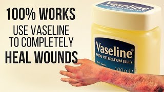 100 WORKS USE VASELINE TO COMPLETELY HEAL WOUNDS [upl. by Piderit901]