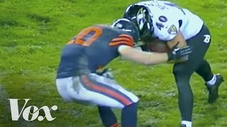 The NFLs concussion crisis explained [upl. by Cornelie]