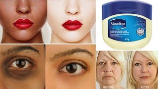 Top 3 Ways To Use Vaseline  Get Fair amp Glowing Skin  Removes Dark Spot Aging Signs amp Dark Circles [upl. by Rasaec615]